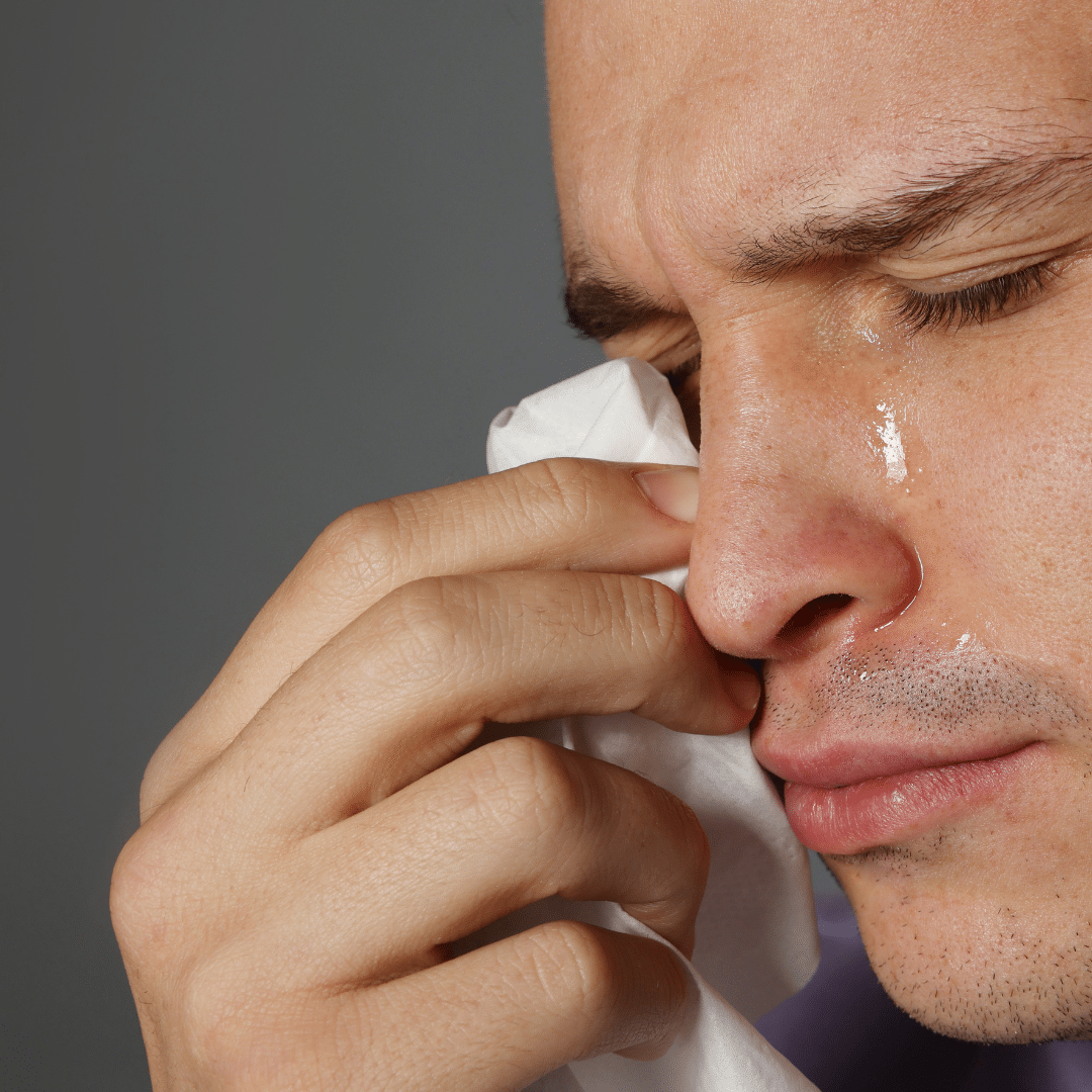 Dry Eyes | Blocked Tear Duct