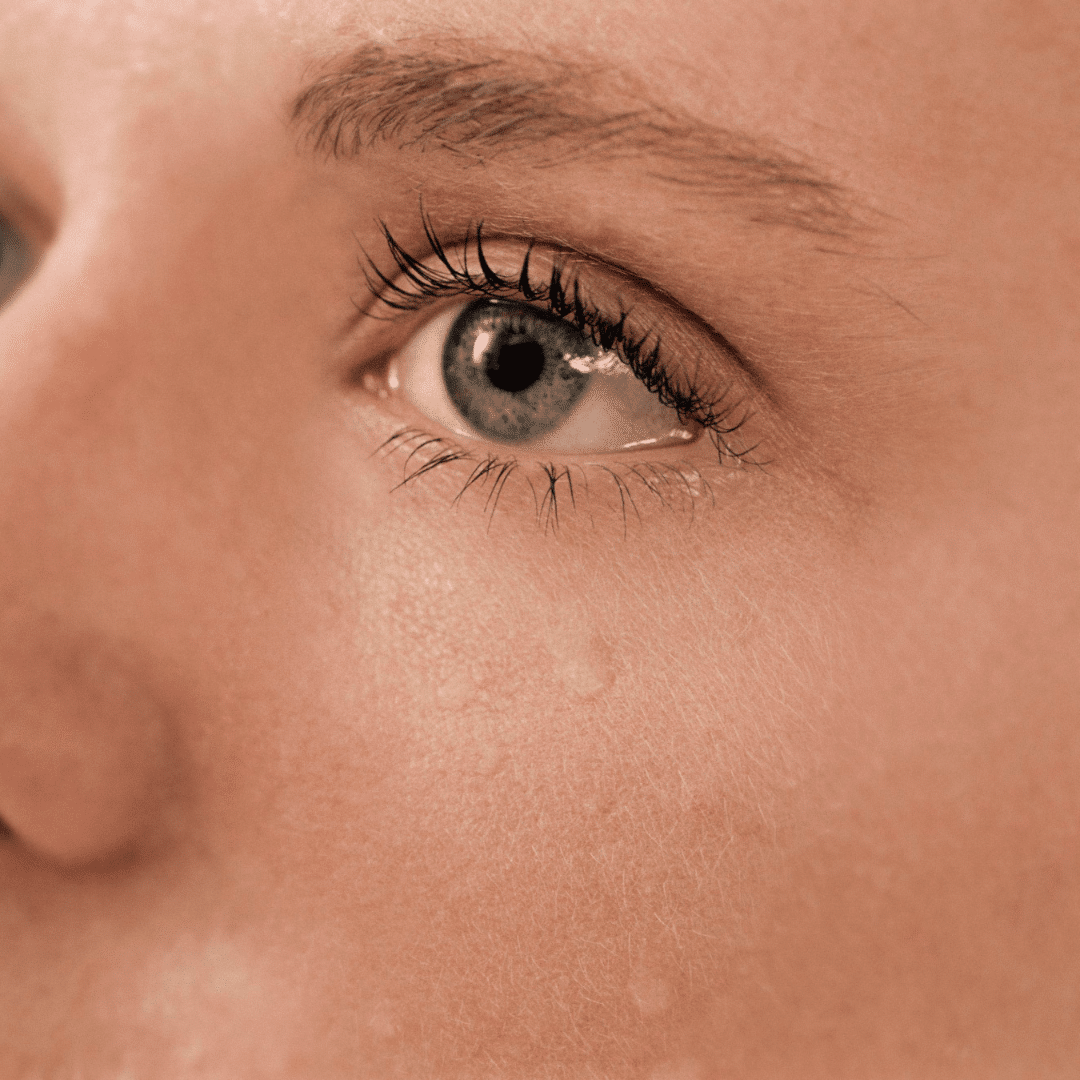 Common Causes of Watery Eyes