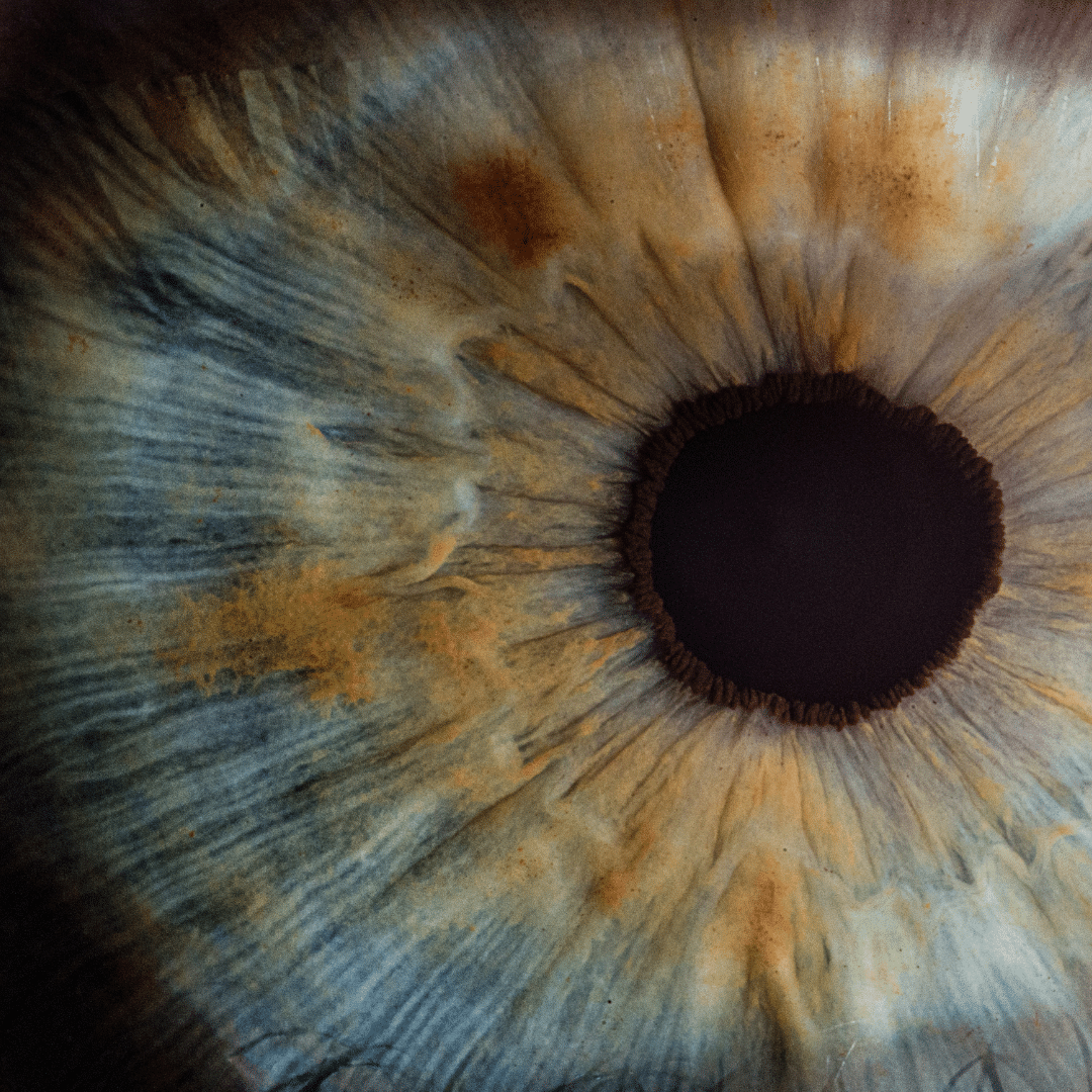 Laser Eye Surgery Aftercare