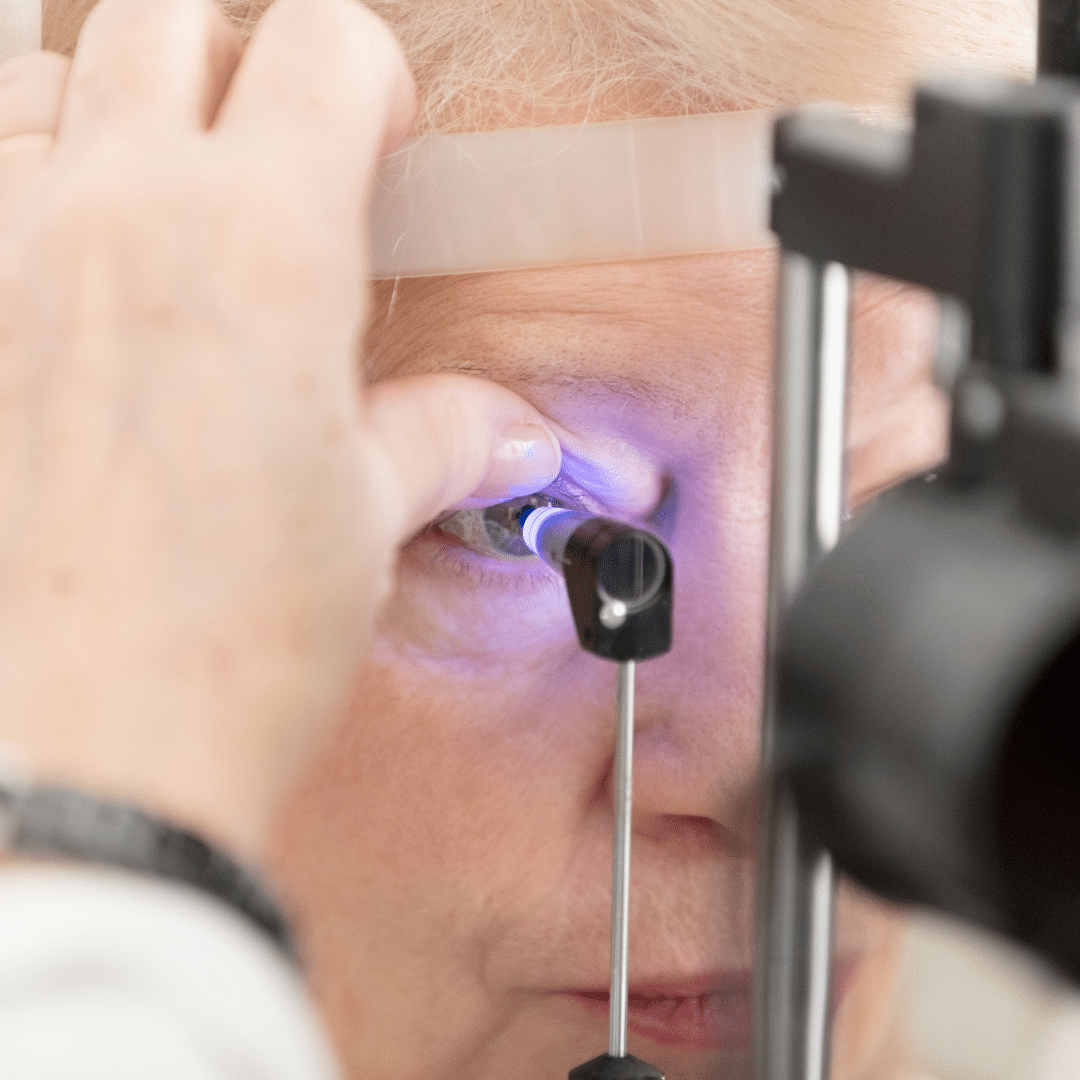 Glaucoma Private Care | Bristol